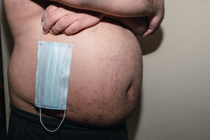 Obesity increases risks of Covid-19, experts say